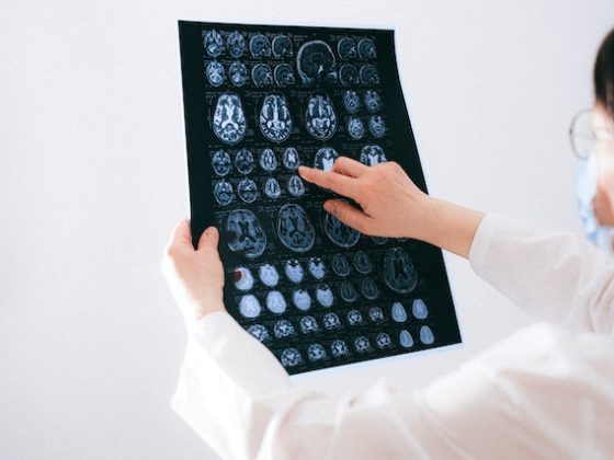 woman pointing at Brain scans photo