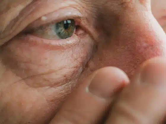 elderly-with-eye-dementia